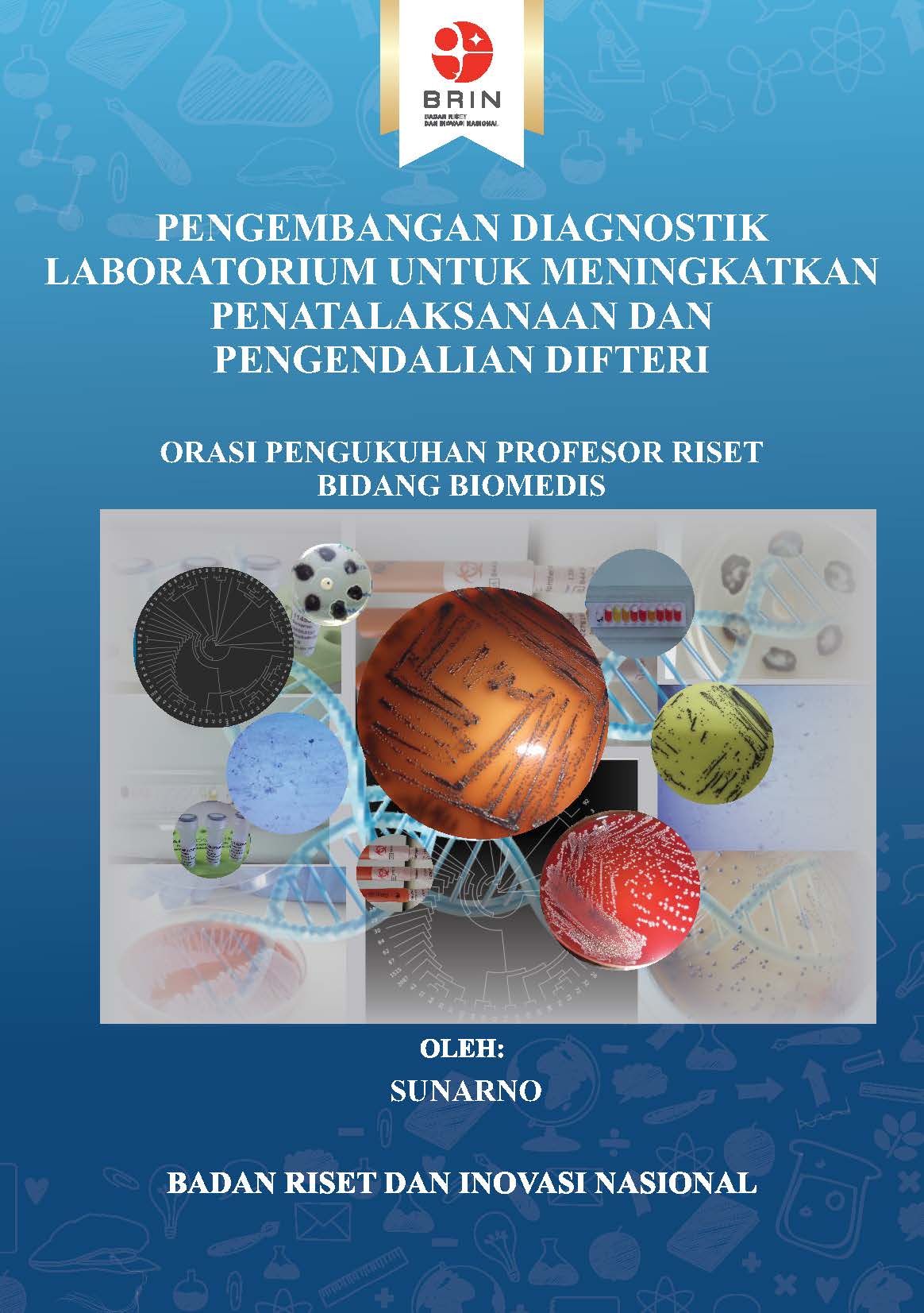 Pengembangan Diagnostik Laboratorium untuk Meningkatkan Penatalaksanaan dan Pengendalian Difteri